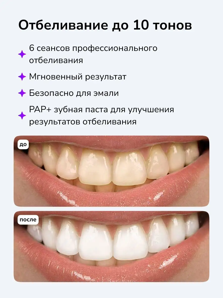 Отбеливание зубов набор Smilebe купить по цене 3 038 ₽ в интернет-магазине  Wildberries | 164565023