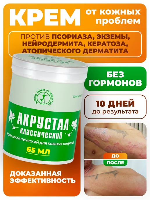 Купить Мазь Акрустал В Аптеках